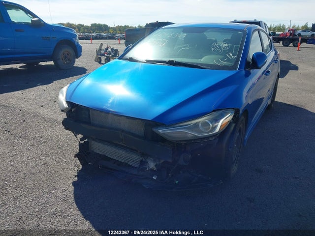 KMHD04LB5JU669943 Hyundai g 1.6 dohc t-gdi