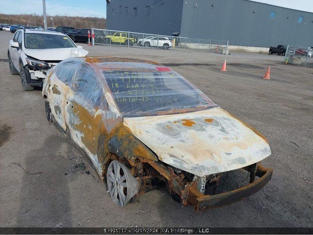 KMHD84LF0JU634609 Hyundai mpi nu