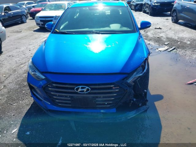 KMHD04LB4JU484329 Hyundai g 1.6 dohc t-gdi