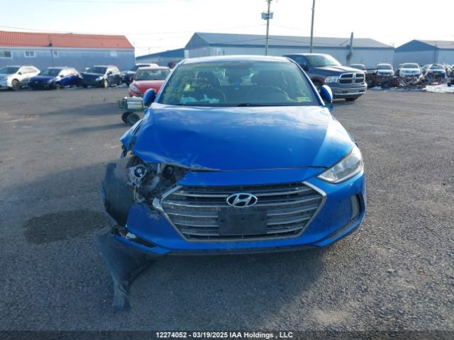 KMHD84LF8HU262284 Hyundai Elantra Se/value/limited
