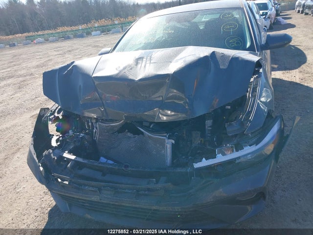 KMHLM4DG8SU934480 Hyundai mpi nu pe