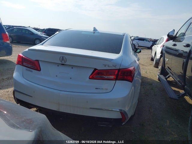 19UUB3F7XJA800254 Acura Tlx Advance