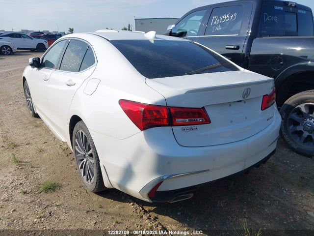 19UUB3F7XJA800254 Acura Tlx Advance