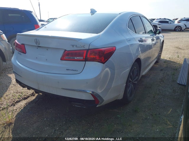 19UUB3F7XJA800254 Acura Tlx Advance