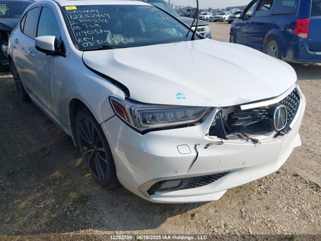 19UUB3F7XJA800254 Acura Tlx Advance