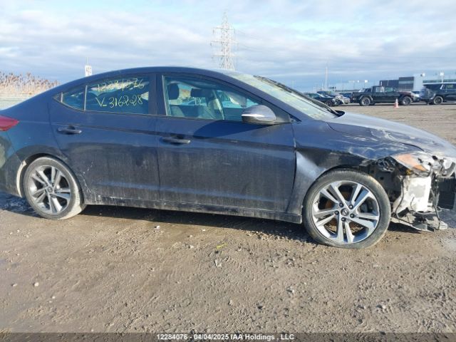 KMHD84LF6HU316228 Hyundai Elantra