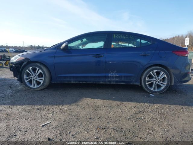 KMHD84LF6HU316228 Hyundai Elantra