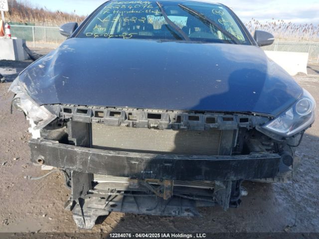 KMHD84LF6HU316228 Hyundai Elantra