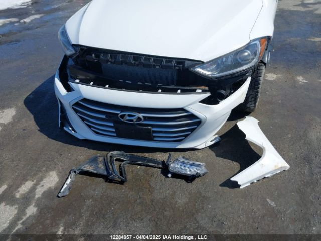 KMHD84LF2JU621456 Hyundai Elantra Sel/value/limited