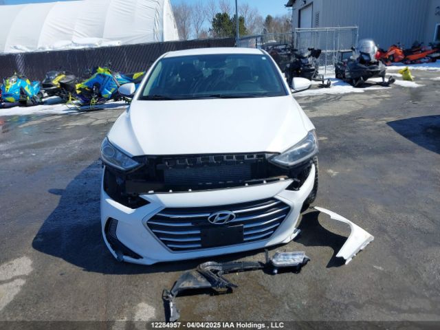 KMHD84LF2JU621456 Hyundai Elantra Sel/value/limited