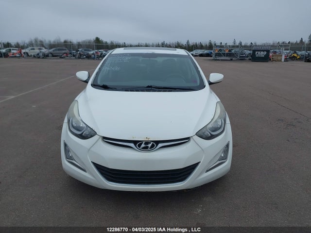 Hyundai dohc mpi nu 2014 5NPDH4AEXEH523788 Image 11