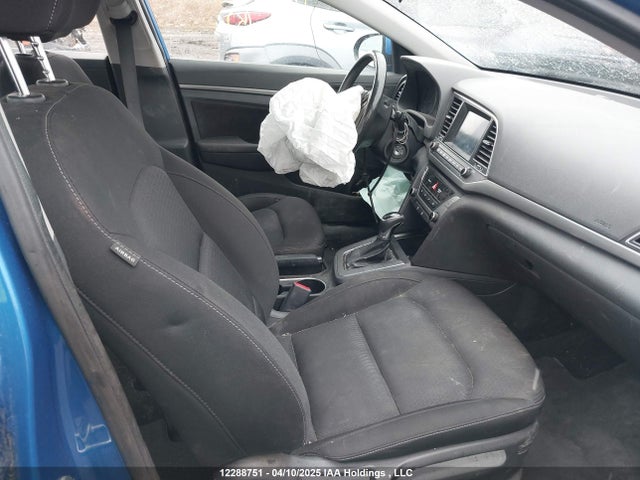 KMHD84LF8JU698011 Hyundai mpi nu