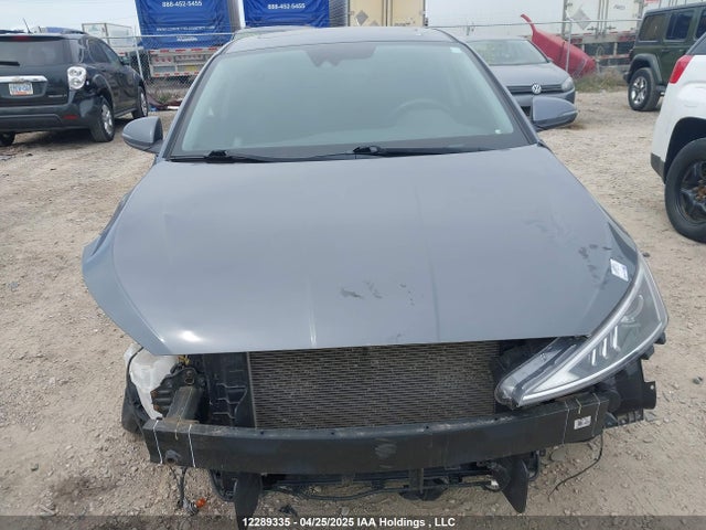 KMHD84LF2LU972631 Hyundai mpi nu