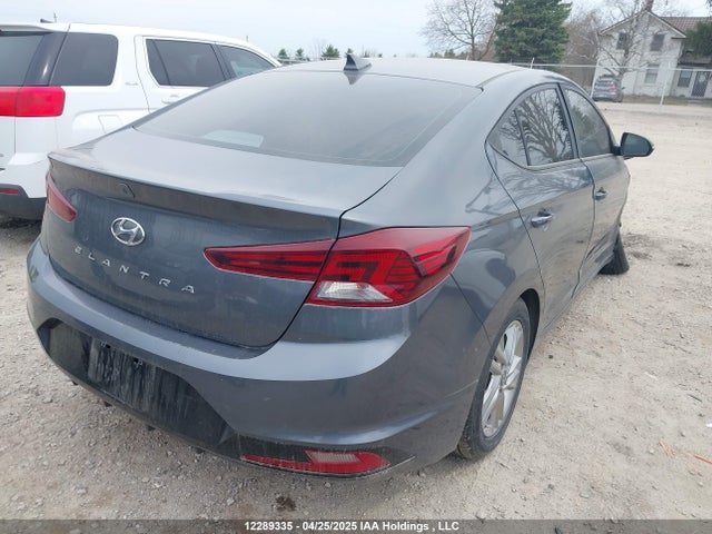 KMHD84LF2LU972631 Hyundai mpi nu