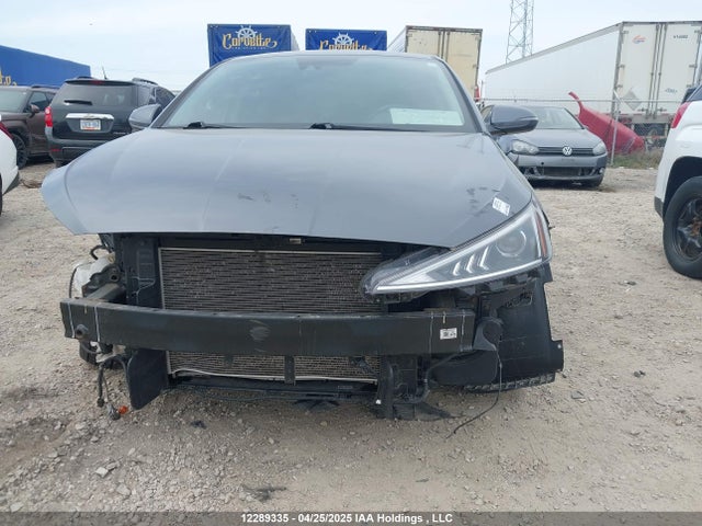 KMHD84LF2LU972631 Hyundai mpi nu
