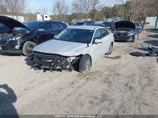 KMHLM4DG8SU860218 Hyundai mpi nu pe