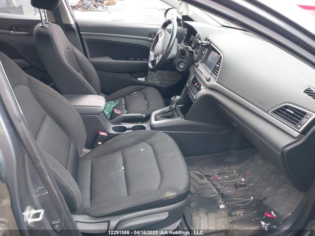 KMHD84LF6HU401411 Hyundai 2017