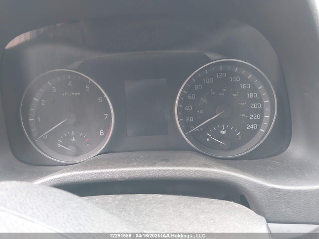 KMHD84LF6HU401411 Hyundai 2017