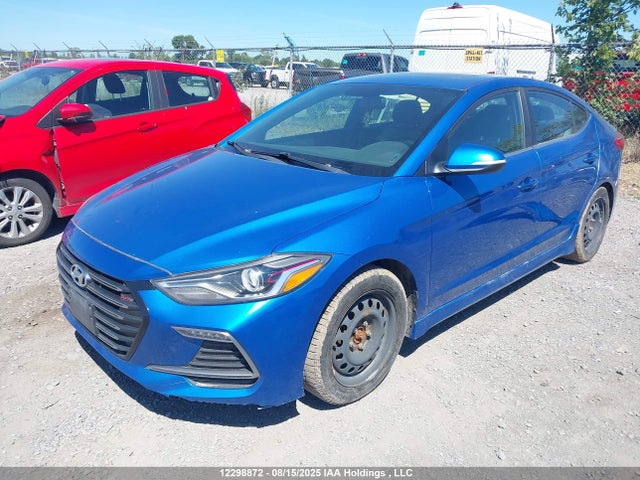 KMHD04LB7JU684573 Hyundai g 1.6 dohc t-gdi