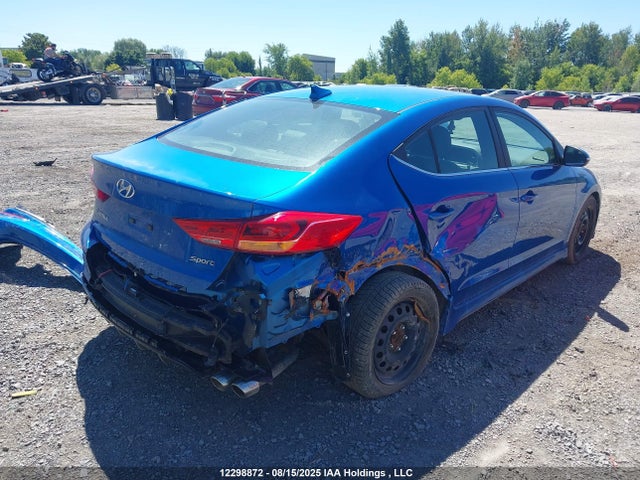 KMHD04LB7JU684573 Hyundai g 1.6 dohc t-gdi