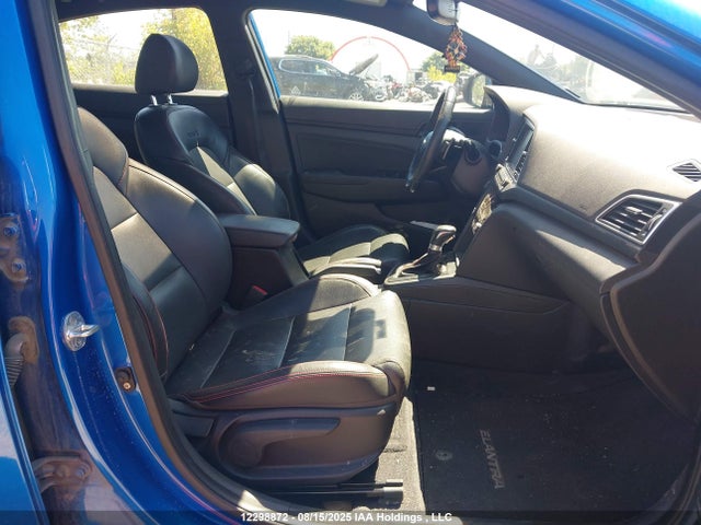 KMHD04LB7JU684573 Hyundai g 1.6 dohc t-gdi