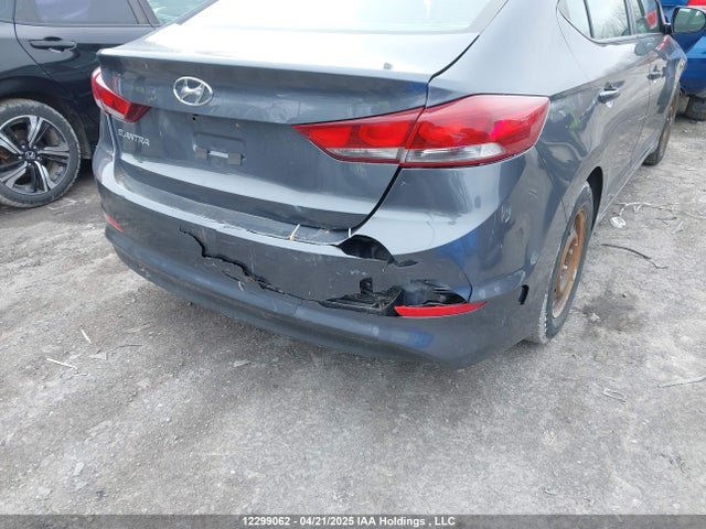 KMHD84LF9HU380294 Hyundai Elantra