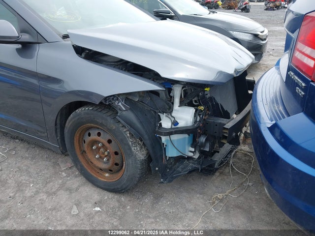 KMHD84LF9HU380294 Hyundai Elantra
