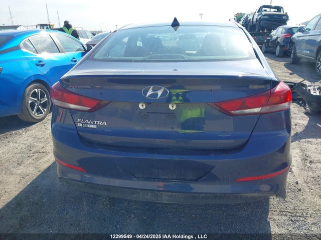 KMHD84LF1JU641343 Hyundai Elantra