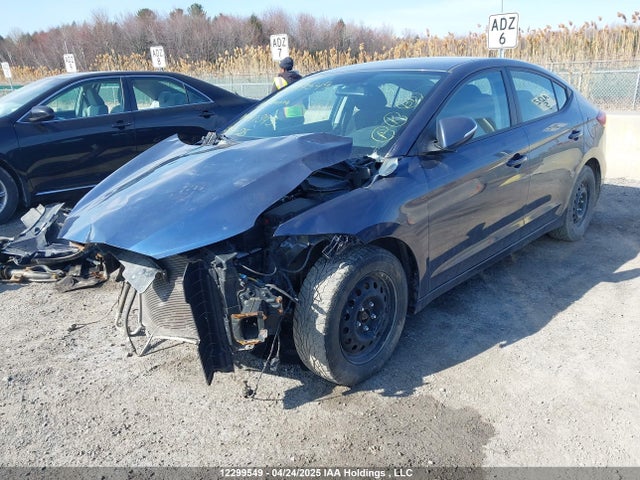 KMHD84LF1JU641343 Hyundai Elantra