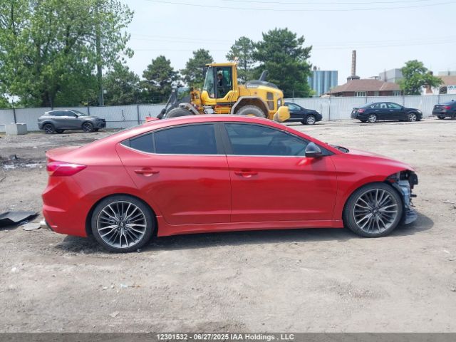 KMHD04LB3JU669665 Hyundai g 1.6 dohc t-gdi