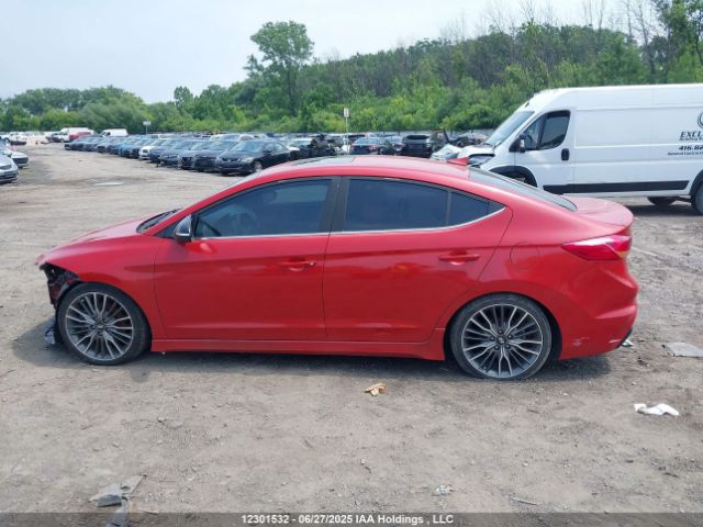 KMHD04LB3JU669665 Hyundai g 1.6 dohc t-gdi