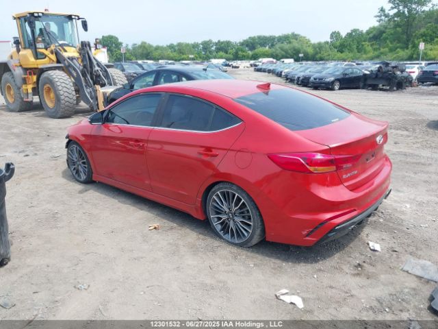 KMHD04LB3JU669665 Hyundai g 1.6 dohc t-gdi