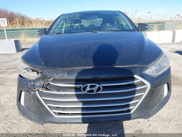 KMHD84LF8HU094551 Hyundai Elantra