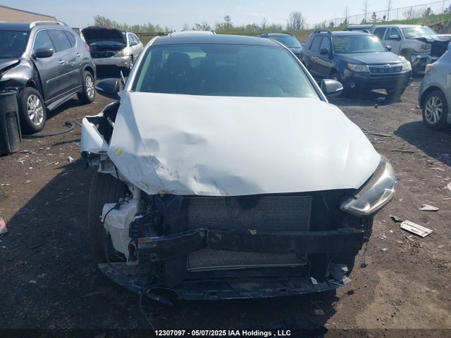 KMHD84LF5HU379207 Hyundai Elantra