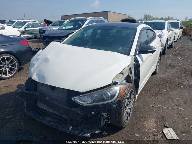 KMHD84LF5HU379207 Hyundai Elantra