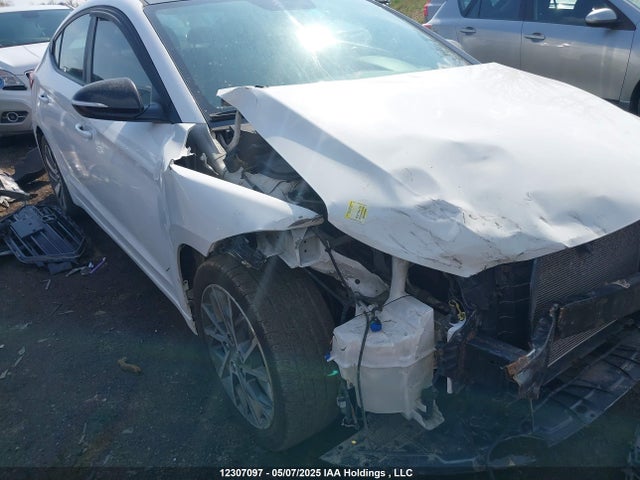 KMHD84LF5HU379207 Hyundai Elantra