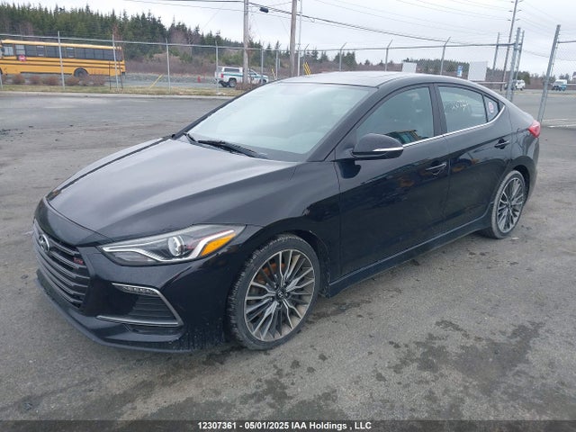 KMHD04LB5JU460122 Hyundai g 1.6 dohc t-gdi