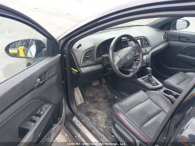 KMHD04LB5JU460122 Hyundai g 1.6 dohc t-gdi