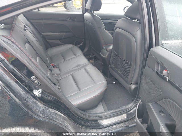 KMHD04LB5JU460122 Hyundai g 1.6 dohc t-gdi