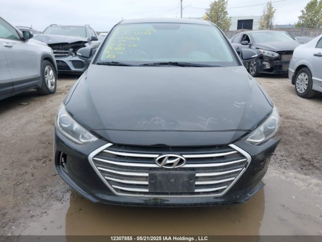 KMHD84LF8JU644269 Hyundai ELANTRA GL