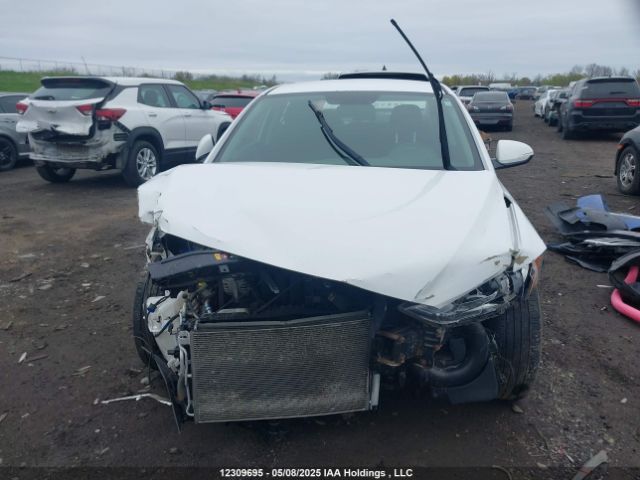 KMHD84LF6HU167030 Hyundai 2017