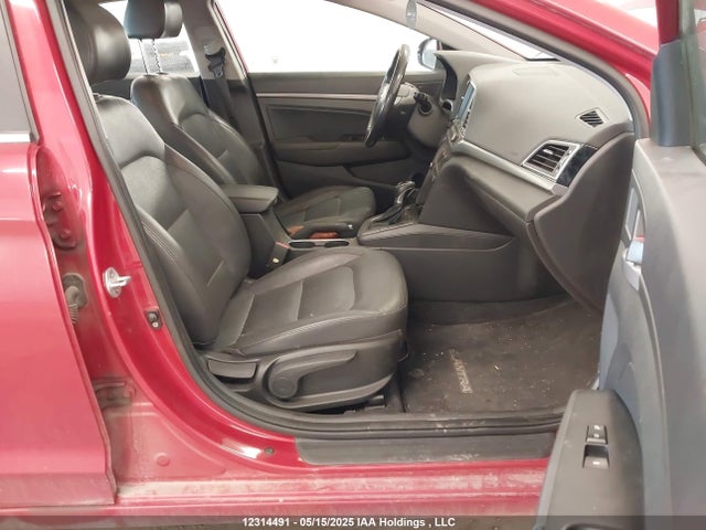 KMHD84LF0HU211183 Hyundai 2017