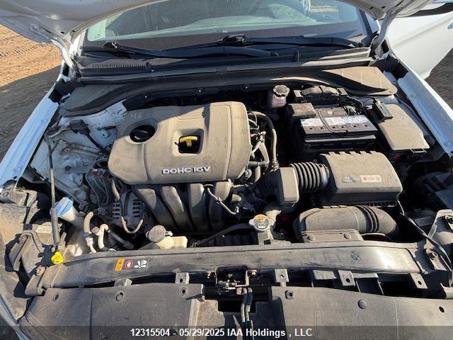KMHD84LFXJU516034 Hyundai ELANTRA GL