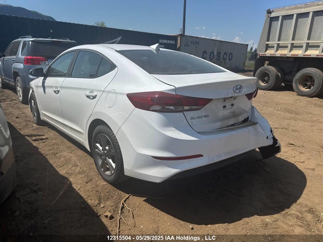 KMHD84LFXJU516034 Hyundai ELANTRA GL