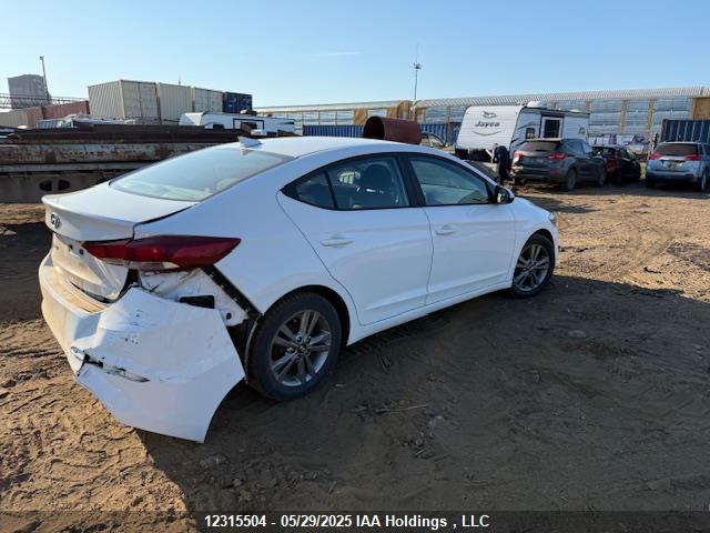 KMHD84LFXJU516034 Hyundai ELANTRA GL