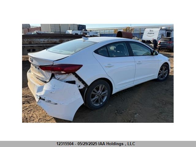KMHD84LFXJU516034 Hyundai ELANTRA GL