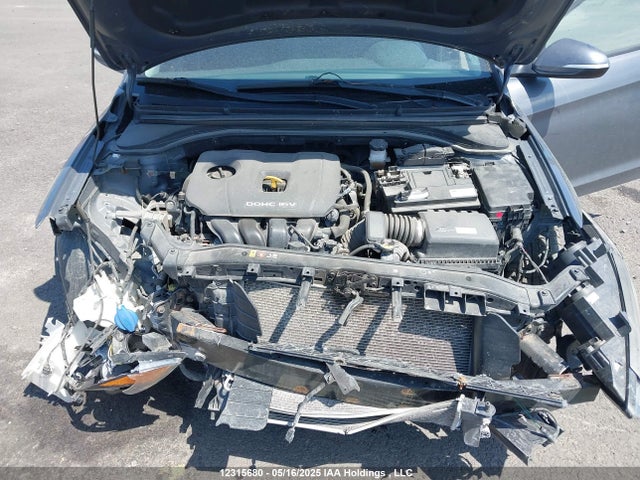 KMHD84LF5HU325583 Hyundai 2017