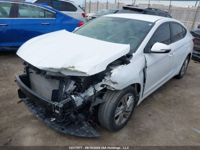 KMHD84LF1LU101493 Hyundai mpi nu