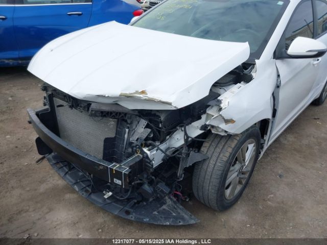KMHD84LF1LU101493 Hyundai mpi nu