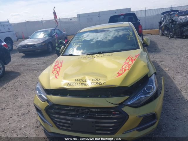 KMHD04LB0JU666299 Hyundai Elantra Sport